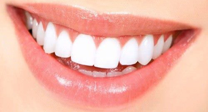 ¡ APROVECHA! Sesión de blanqueamiento dental en clínica gratuita al realizarse una limpieza bucal