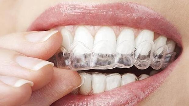¡CUIDA TUS DIENTES! Evita el desgaste dental con una férula de descarga a precio de vértigo