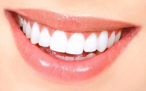 ¡ APROVECHA! Sesión de blanqueamiento dental en clínica gratuita al realizarse una limpieza bucal